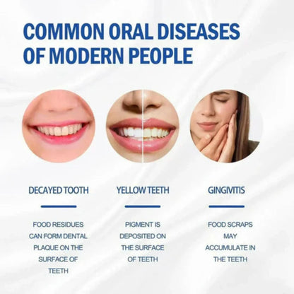 SP-4 Probiotic Brightening and cleaning toothpaste (Buy1 Get 1 Free)